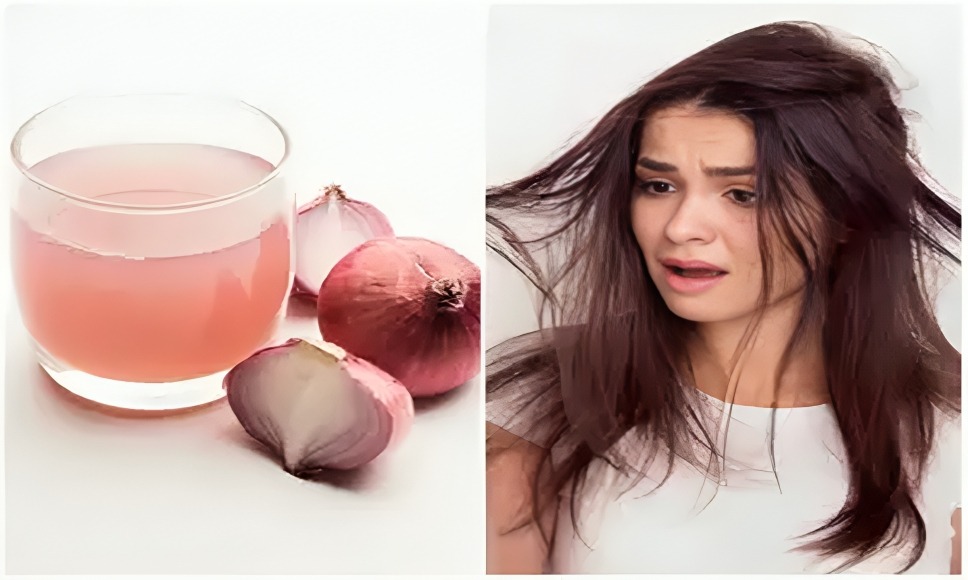 Benefits Of Onion Mask For Healthy Hair