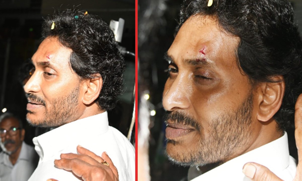 Kodi Katthi and Stone Attack : Public Reaction towards Jagan Mohan Reddy’s Injuries